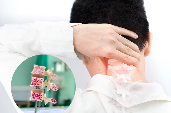 Cervical Spine Tumor